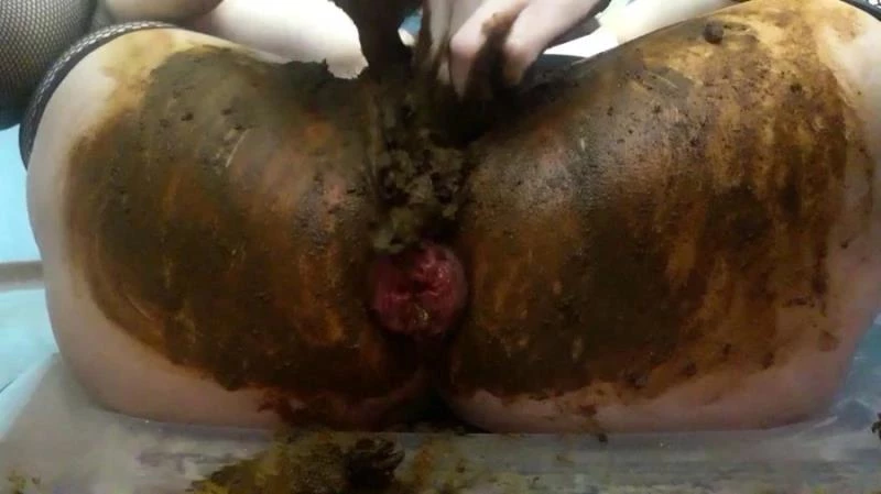 Anal Prolapse In Shit - Toilet 2024 [FullHD]